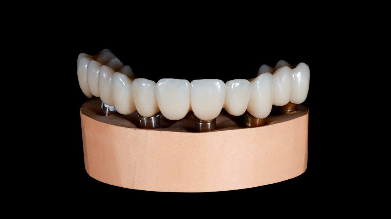 Implant