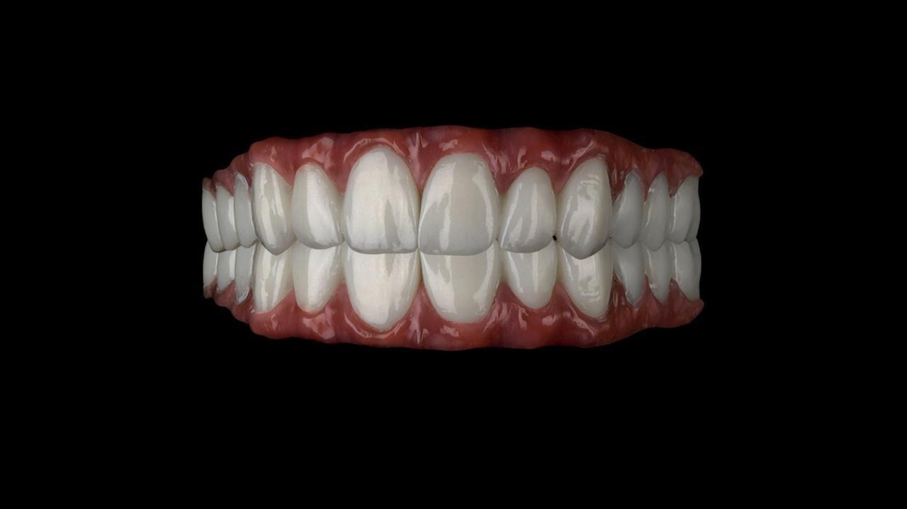 Zirconia